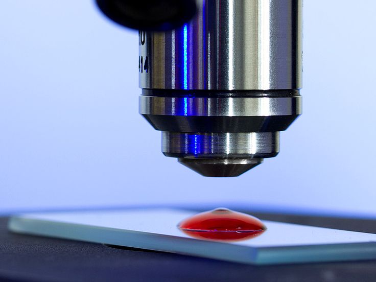 CancerSEEK_ Blood Test That Detects Eight Common Cancers